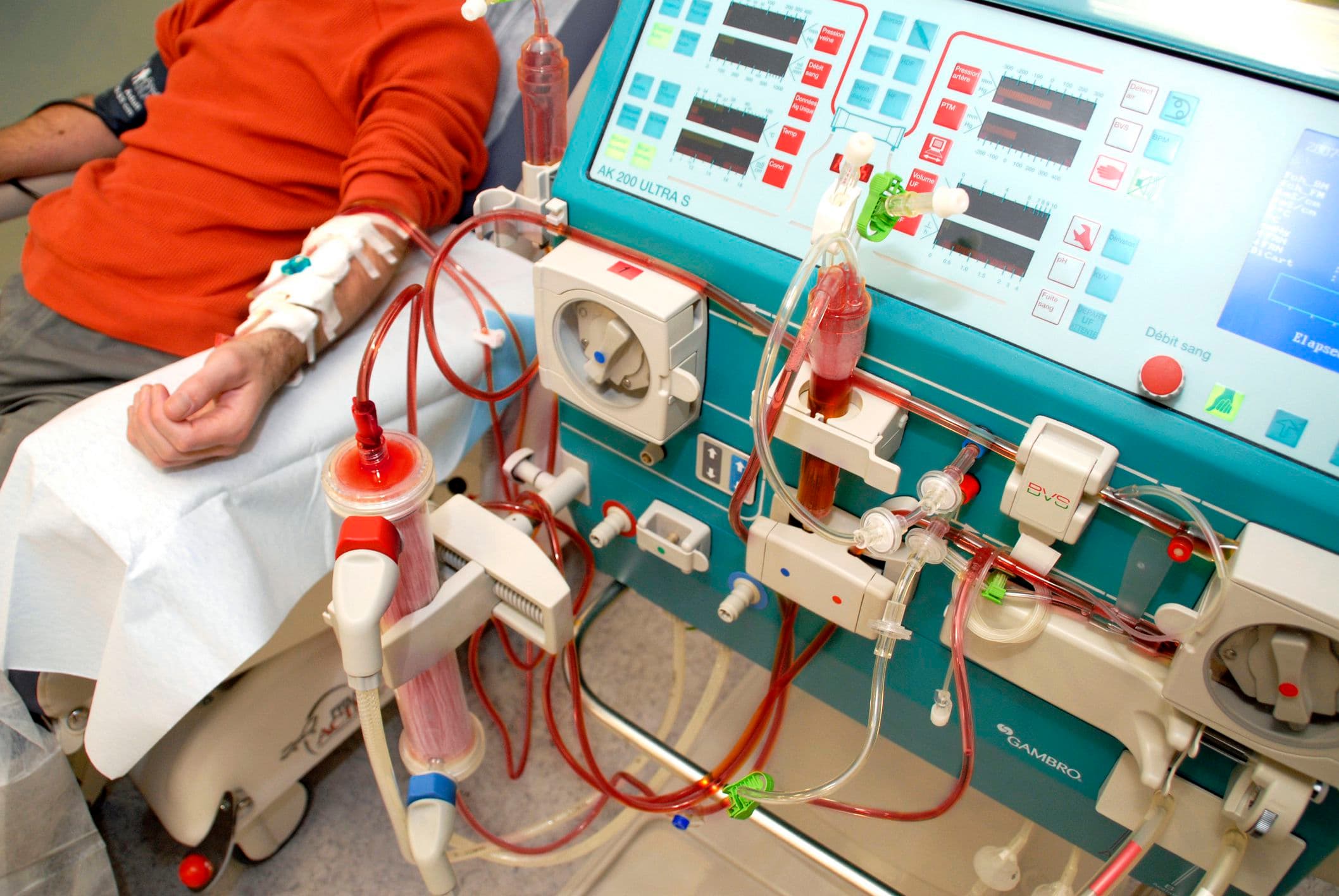 Patient undergoing dialysis session.